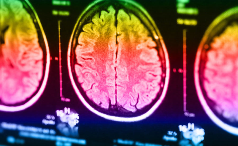 BrainImaging