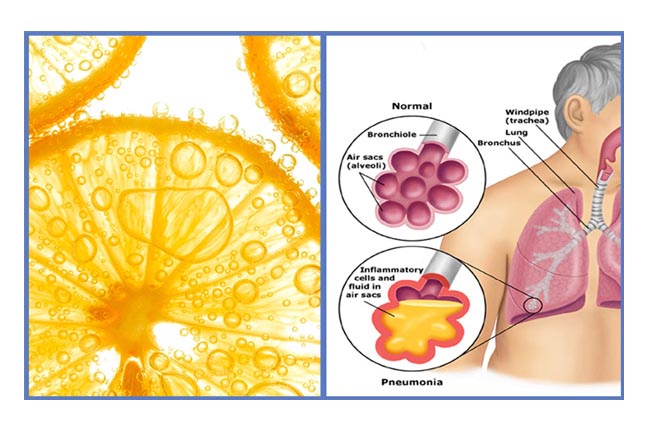 VitC-Pneumonia_2