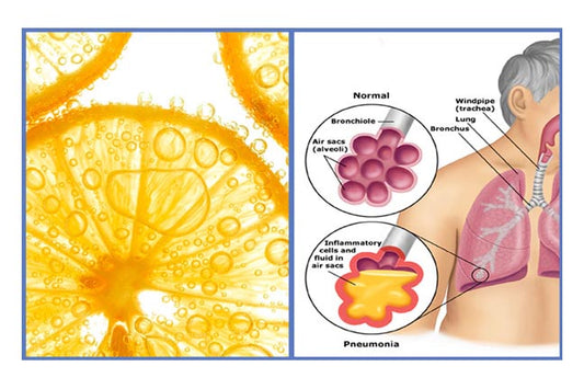 VitC-Pneumonia_2