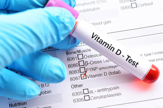VitaminD-Test-Graphic