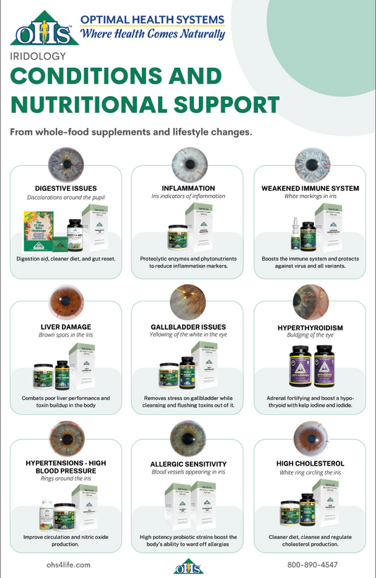 Iridology Poster PNG Iridology Poster